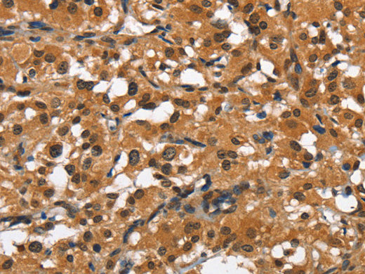 SLAMF8 Polyclonal Antibody Store at -20°C - MSE Supplies LLC