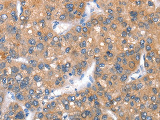 CD238 Polyclonal Antibody Store at -20°C - MSE Supplies LLC