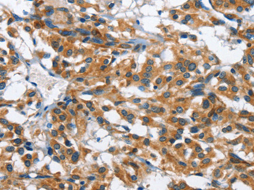 BPI Polyclonal Antibody Store at -20°C - MSE Supplies LLC