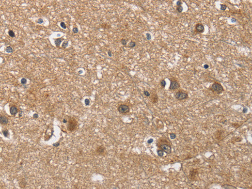 BUB1 Polyclonal Antibody Store at -20°C - MSE Supplies LLC