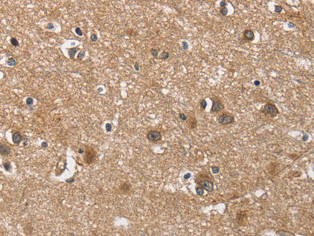 BUB1 Polyclonal Antibody Store at -20°C - MSE Supplies LLC