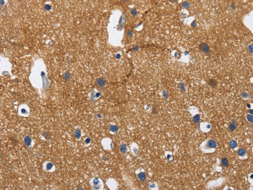 CADM3 Polyclonal Antibody Store at -20°C - MSE Supplies LLC