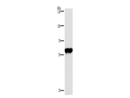 PPP3CA Polyclonal Antibody Store at -20°C - MSE Supplies LLC