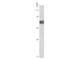 CALU Polyclonal Antibody Store at -20°C - MSE Supplies LLC