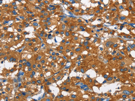 CAMK1D Polyclonal Antibody Store at -20°C - MSE Supplies LLC