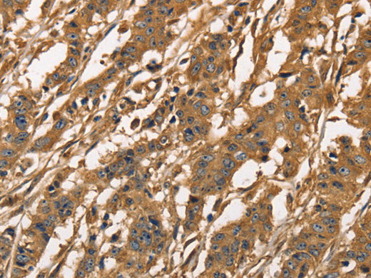 CAPZA3 Polyclonal Antibody Store at -20°C - MSE Supplies LLC