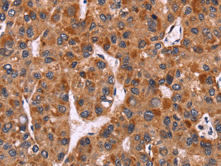 CARD11 Polyclonal Antibody Store at -20°C - MSE Supplies LLC