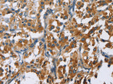 CARD9 Polyclonal Antibody Store at -20°C - MSE Supplies LLC