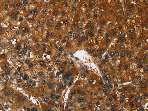 CATSPER4 Polyclonal Antibody Store at -20°C - MSE Supplies LLC