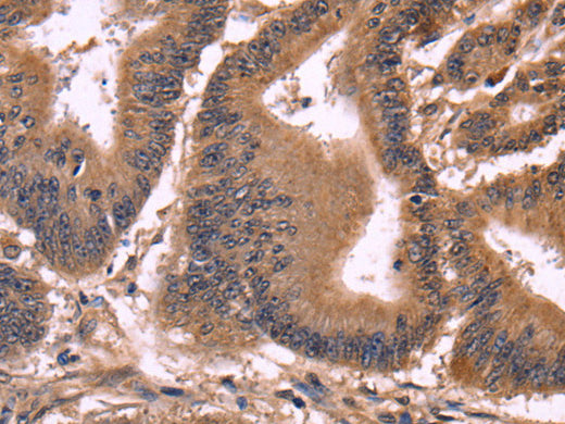 CCDC106 Polyclonal Antibody Store at -20°C - MSE Supplies LLC