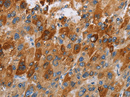 CCR9 Polyclonal Antibody Store at -20°C - MSE Supplies LLC