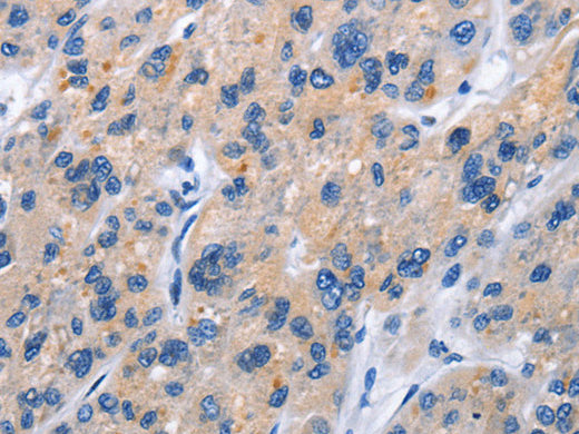 CD137 Polyclonal Antibody Store at -20°C - MSE Supplies LLC