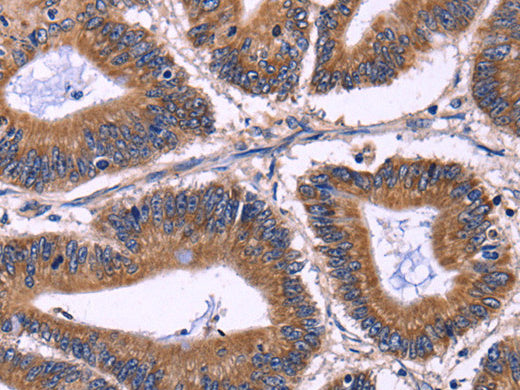 KIR2DL1/3/4/S4 Polyclonal Antibody Store at -20°C - MSE Supplies LLC