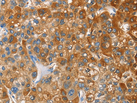 OX2R Polyclonal Antibody Store at -20°C - MSE Supplies LLC