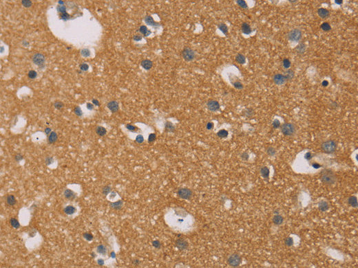 CD22 Polyclonal Antibody Store at -20°C - MSE Supplies LLC