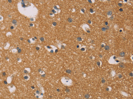 CD22 Polyclonal Antibody Store at -20°C - MSE Supplies LLC