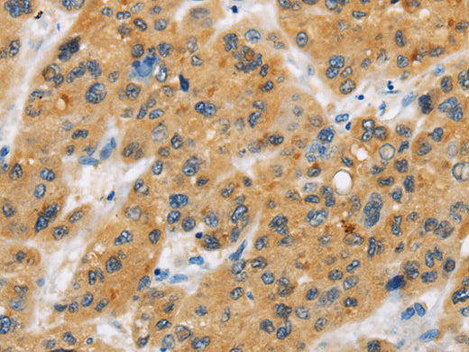 CD272 Polyclonal Antibody Store at -20°C - MSE Supplies LLC