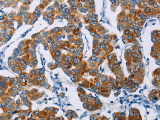 NCR3 Polyclonal Antibody Store at -20°C - MSE Supplies LLC