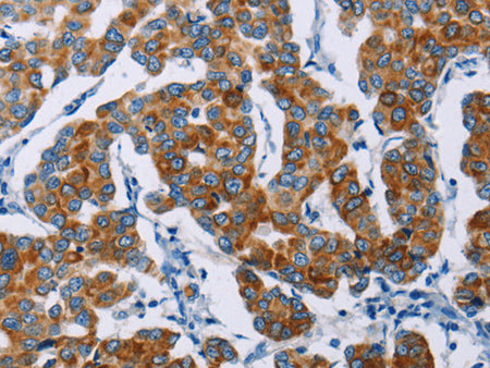 NCR3 Polyclonal Antibody Store at -20°C - MSE Supplies LLC