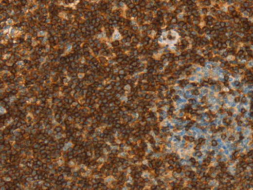 CD43 Polyclonal Antibody Store at -20°C - MSE Supplies LLC