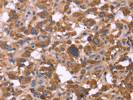 FBXW7 Polyclonal Antibody Store at -20°C - MSE Supplies LLC