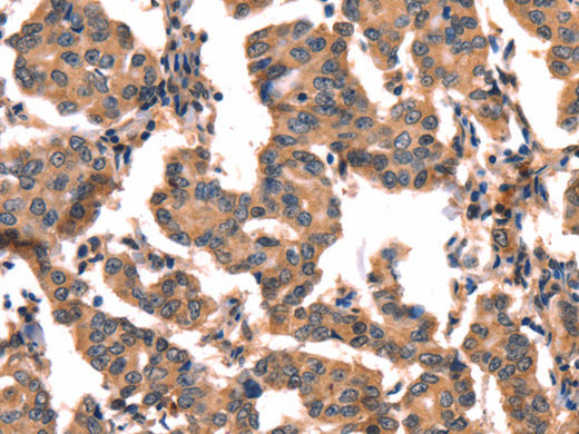 hCG Polyclonal Antibody Store at -20°C - MSE Supplies LLC