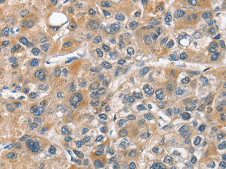 CHMP4B Polyclonal Antibody Store at -20°C - MSE Supplies LLC