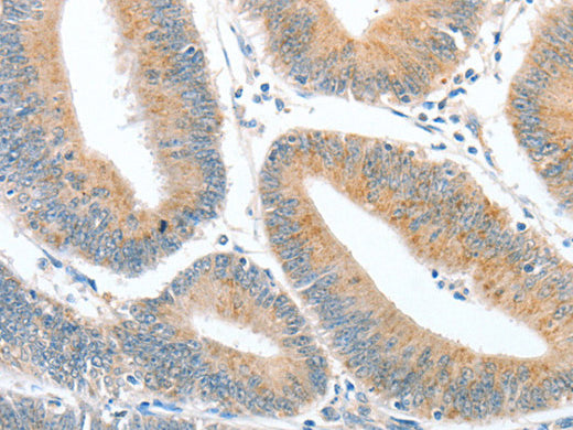 CKAP2 Polyclonal Antibody Store at -20°C - MSE Supplies LLC