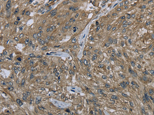 CLPS Polyclonal Antibody Store at -20°C - MSE Supplies LLC
