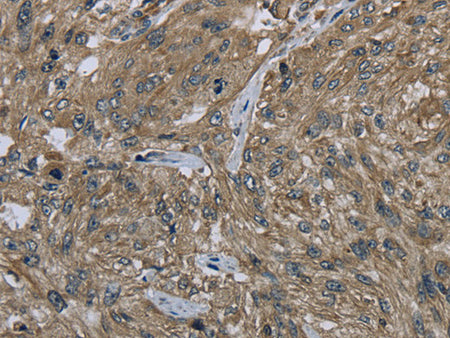 CLPS Polyclonal Antibody Store at -20°C - MSE Supplies LLC