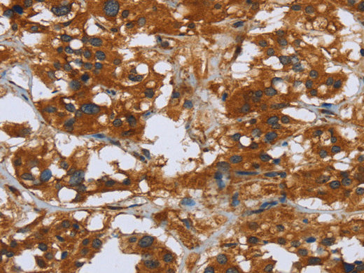 COMP Polyclonal Antibody Store at -20°C - MSE Supplies LLC