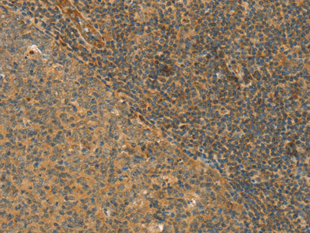 CPA2 Polyclonal Antibody Store at -20°C - MSE Supplies LLC