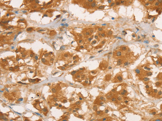 CPB1 Polyclonal Antibody Store at -20°C - MSE Supplies LLC