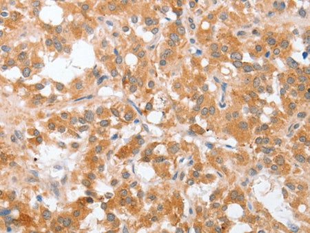 cPLA2 Polyclonal Antibody Store at -20°C - MSE Supplies LLC