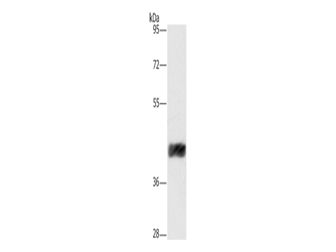 CRELD2 Polyclonal Antibody Store at -20°C - MSE Supplies LLC