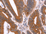 CRISP3 Polyclonal Antibody Store at -20°C - MSE Supplies LLC