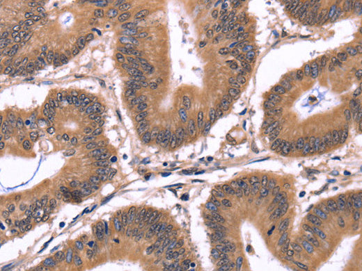 CRK Polyclonal Antibody Store at -20°C - MSE Supplies LLC