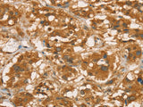 RBBP8 Polyclonal Antibody Store at -20°C - MSE Supplies LLC