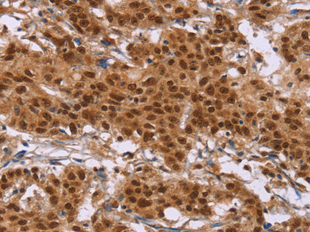 CTNNBL1 Polyclonal Antibody Store at -20°C - MSE Supplies LLC