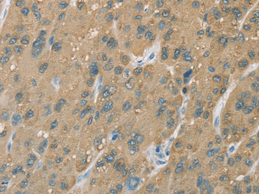 CYP2C9 Polyclonal Antibody Store at -20°C - MSE Supplies LLC