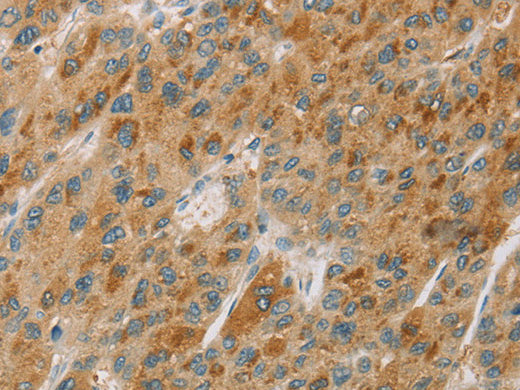 CYP11B1 Polyclonal Antibody Store at -20°C - MSE Supplies LLC