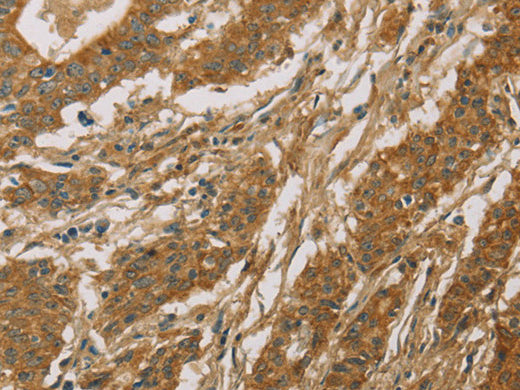 CYP39A1 Polyclonal Antibody Store at -20°C - MSE Supplies LLC