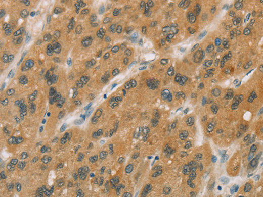 CYP11A1 Polyclonal Antibody Store at -20°C - MSE Supplies LLC