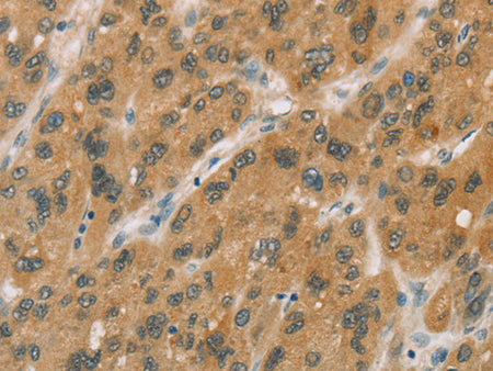 CYP11A1 Polyclonal Antibody Store at -20°C - MSE Supplies LLC