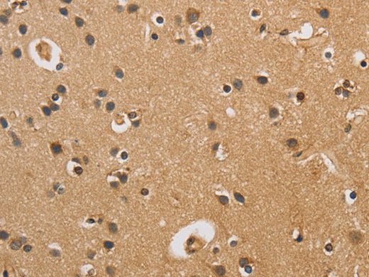 CST6 Polyclonal Antibody Store at -20°C - MSE Supplies LLC