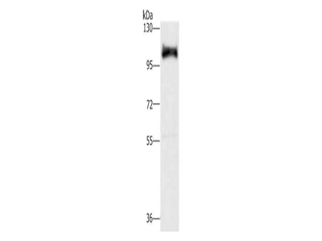 DAB2 Polyclonal Antibody Store at -20°C - MSE Supplies LLC