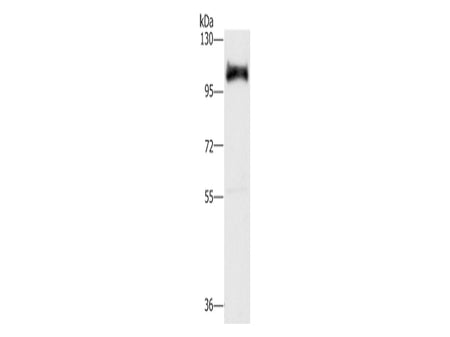 DAB2 Polyclonal Antibody Store at -20°C - MSE Supplies LLC
