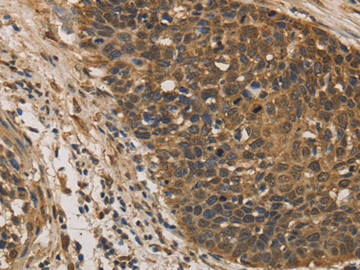 DACH1 Polyclonal Antibody Store at -20°C - MSE Supplies LLC