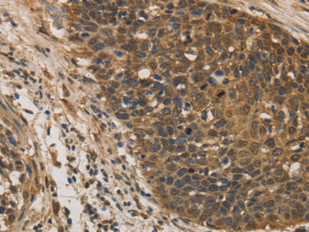 DACH1 Polyclonal Antibody Store at -20°C - MSE Supplies LLC