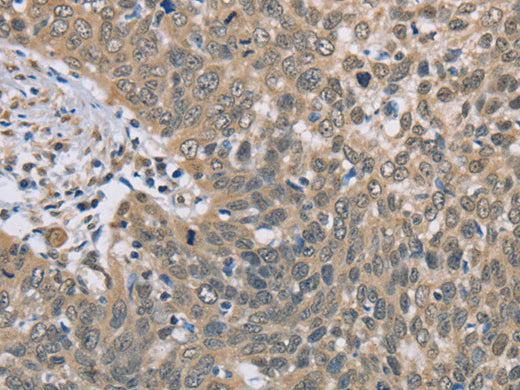 DACH2 Polyclonal Antibody Store at -20°C - MSE Supplies LLC